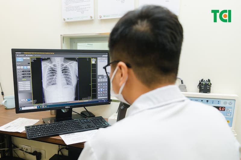 chẩn đoán viêm mũi xoang theo epos 2020