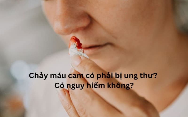 chảy máu mũi ung thư