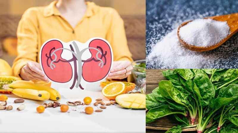 Chế độ ăn giàu natri ảnh hưởng đến sự hình thành sỏi thận