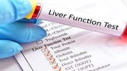 Chỉ số AST máu cao là bệnh gì?