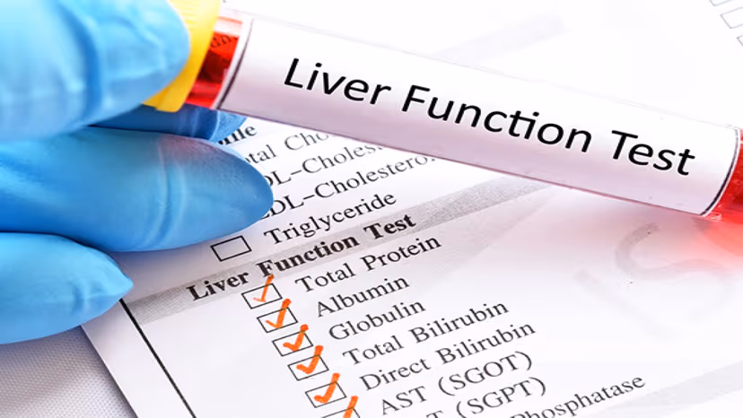 Chỉ số AST máu cao là bệnh gì?