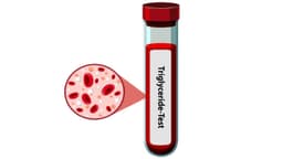 Chỉ số Triglyceride cao bao nhiêu là nguy hiểm?