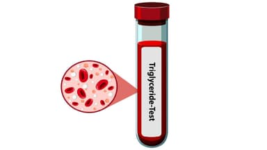 Chỉ số Triglyceride cao bao nhiêu là nguy hiểm?