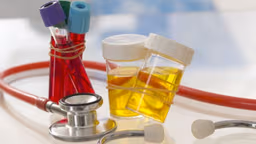 Đến tháng có xét nghiệm nước tiểu được không?