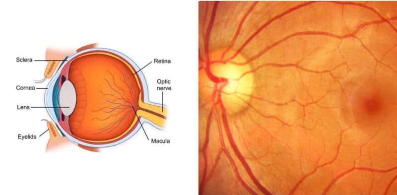 điều trị thoái hóa võng mạc