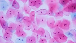 Epithelial cells trong xét nghiệm nước tiểu là gì?