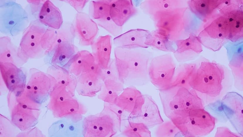 Epithelial cells trong xét nghiệm nước tiểu là gì?