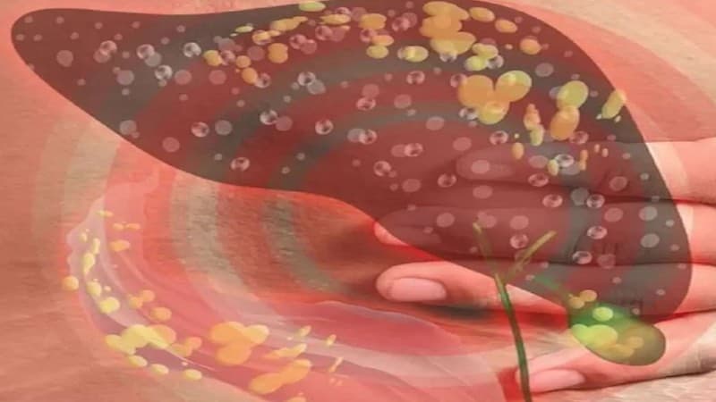 gan nhiễm mỡ độ 4 sống được bao lâu