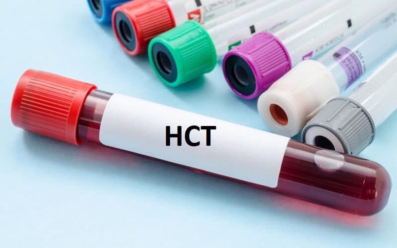 hct thấp trong xét nghiệm máu là gì