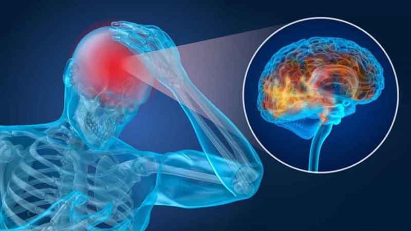 Nguyên nhân rối loạn tiền đình trung ương