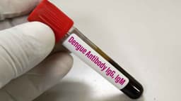 IgM âm tính IgG dương tính trong sốt xuất huyết nghĩa là gì?