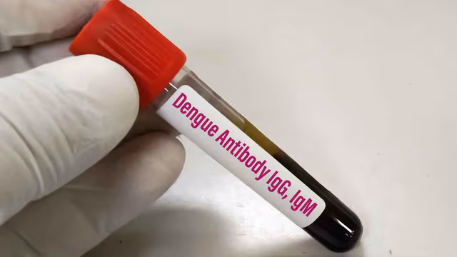 IgM âm tính IgG dương tính trong sốt xuất huyết nghĩa là gì?