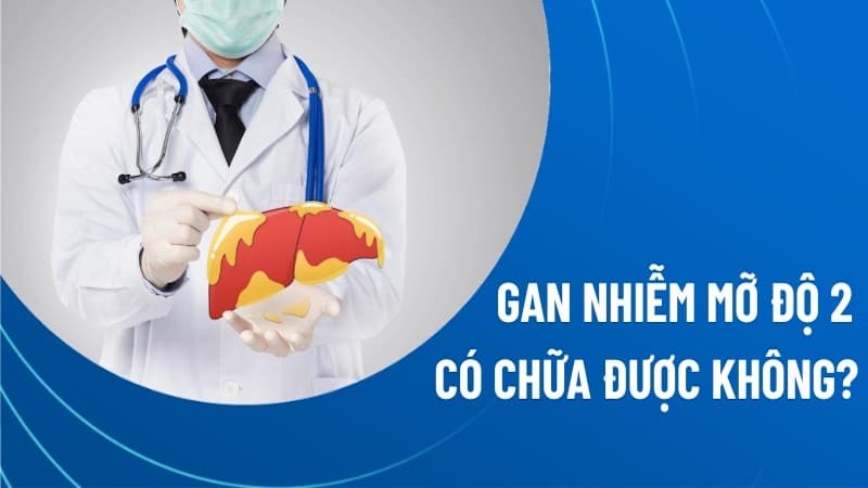 gan nhiễm mỡ độ 2 có chữa khỏi được không