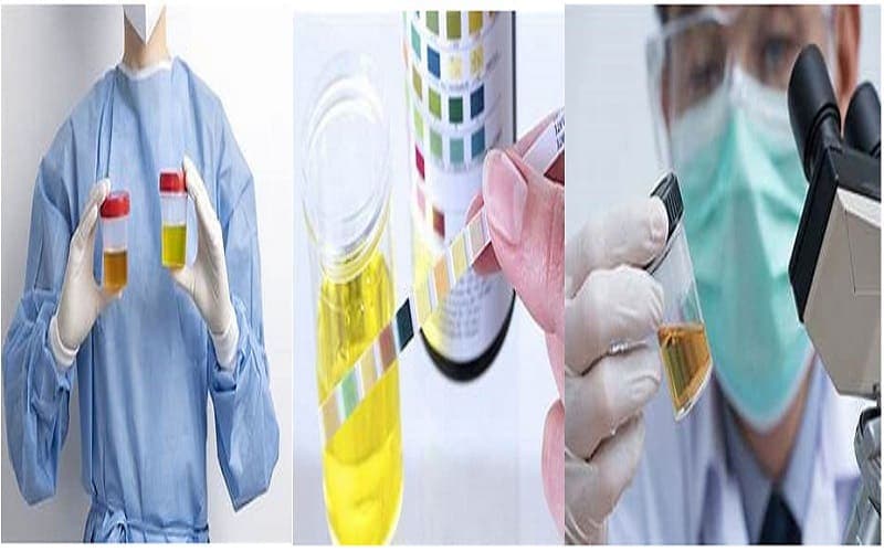 norm trong xét nghiệm nước tiểu là gì