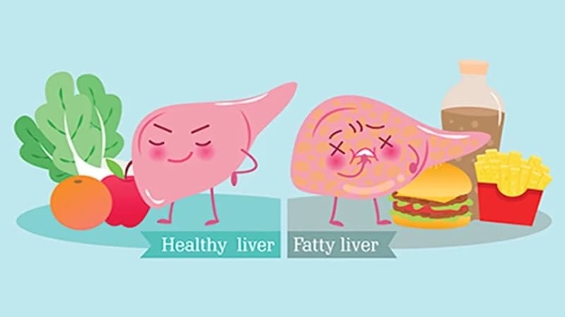 chế độ ăn cho người gan nhiễm mỡ độ 2