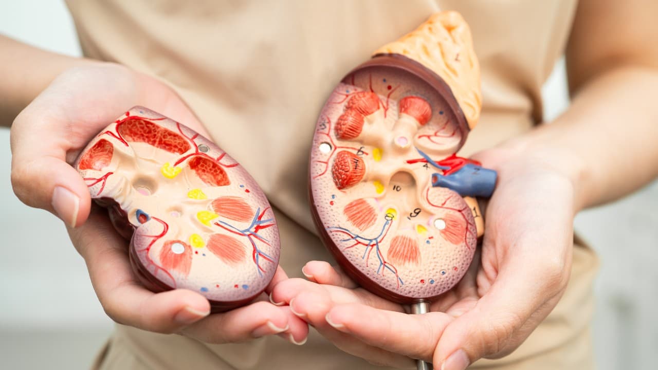 Hình ảnh minh họa bị sỏi thận