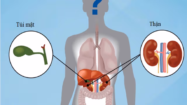 Sỏi thận và sỏi mật cái nào nguy hiểm hơn?