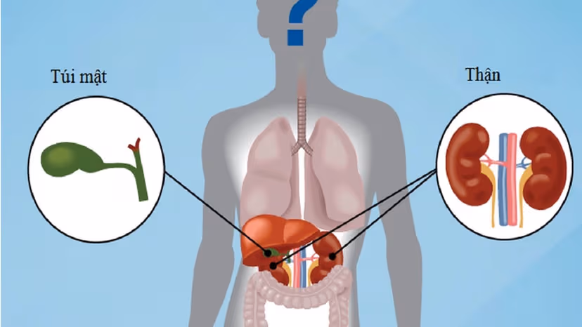 Sỏi thận và sỏi mật cái nào nguy hiểm hơn?