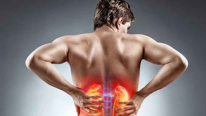 Suy thận và sỏi thận khác nhau như thế nào?