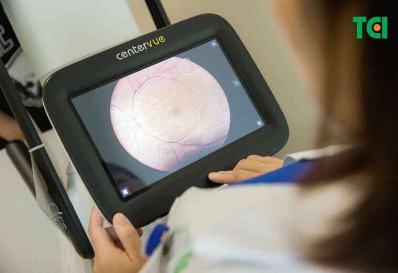 thoái hóa võng mạc do cận thị