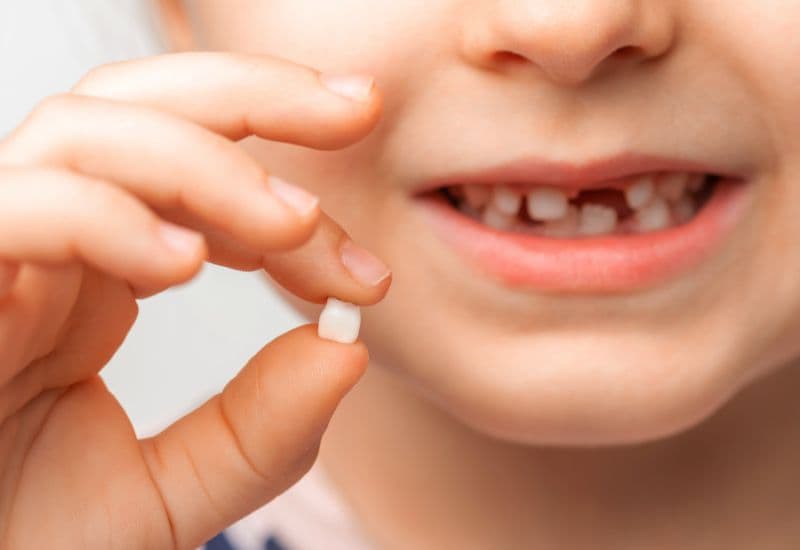 Thứ tự thay răng sữa ở trẻ em theo tuổi