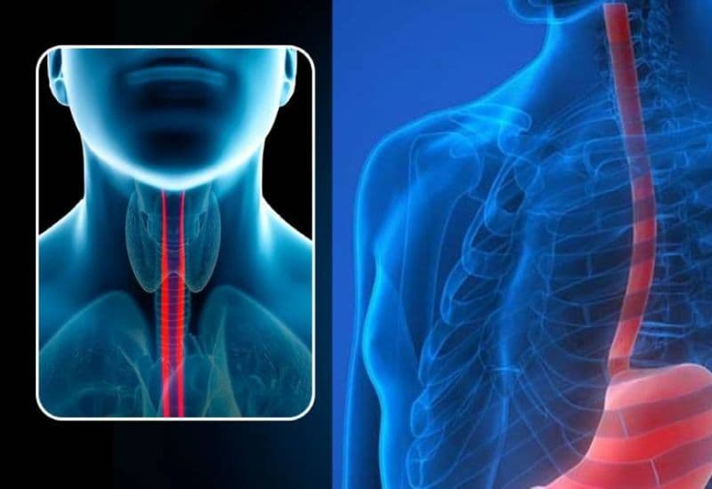 đường tiêu hoá trên