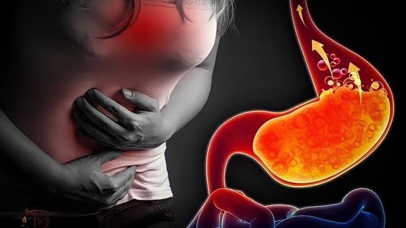 thuốc giảm axit dạ dày