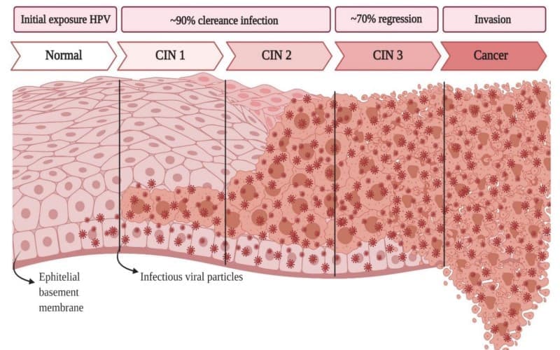 u tân sinh có phải ung thư không