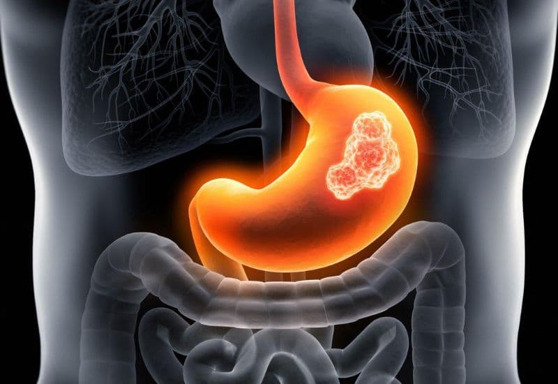 đường tiêu hoá trên