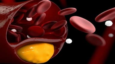 Uống thuốc giảm mỡ máu có hại gì không?