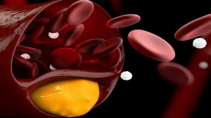 Uống thuốc giảm mỡ máu có hại gì không?