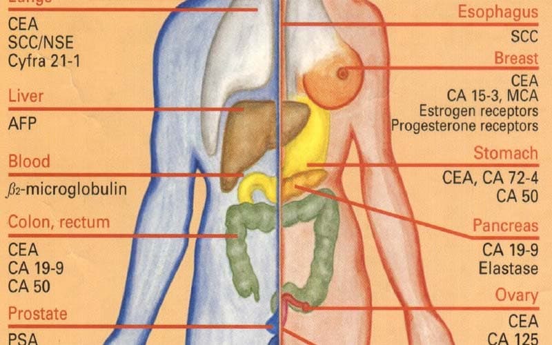 xét nghiệm máu có phát hiện ung thư dạ dày
