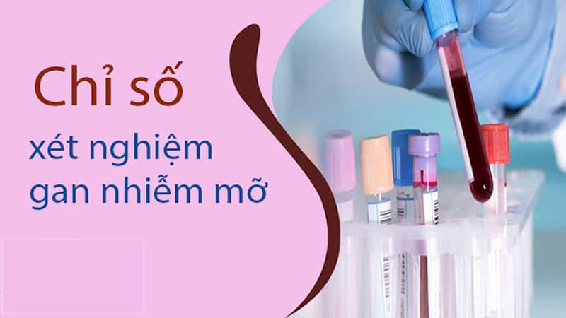 chỉ số gan nhiễm mỡ độ 3