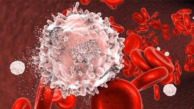 Xét nghiệm máu có phát hiện ung thư máu không?