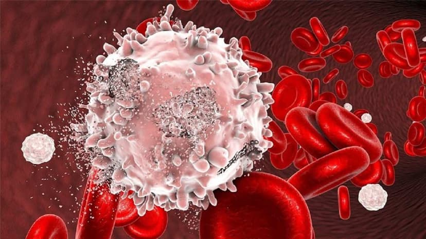 Xét nghiệm máu có phát hiện ung thư máu không?