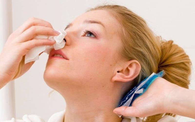 chảy máu mũi ung thư