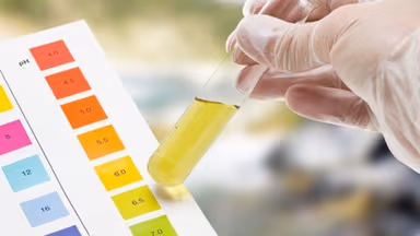 Bà bầu xét nghiệm nước tiểu khi nào trong suốt thai kỳ?