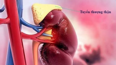 Phác đồ điều trị suy tuyến thượng thận mạn