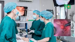 Nội soi cắt polyp dạ dày: Quy trình và lưu ý quan trọng