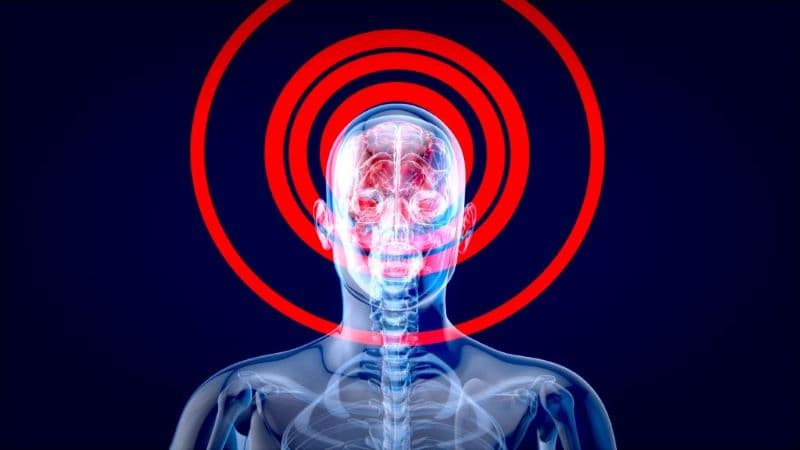 viêm màng não do vi khuẩn