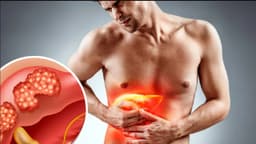 Nguy cơ áp xe gan ở người bệnh đái tháo đường