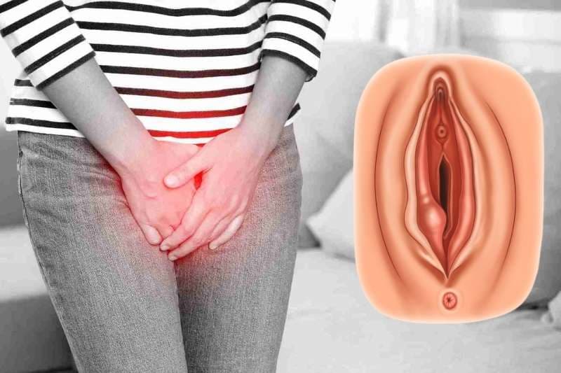 áp xe tuyến bartholin là gì