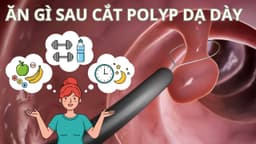 Cắt polyp dạ dày bao lâu thì ăn được? Nên ăn gì sau cắt?