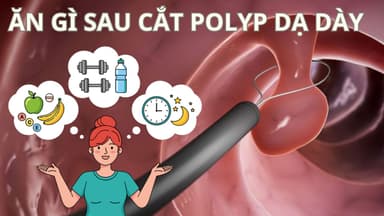Cắt polyp dạ dày bao lâu thì ăn được? Nên ăn gì sau cắt?
