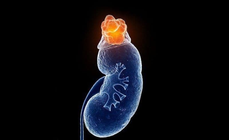 phác đồ điều trị suy tuyến thượng thận mạn