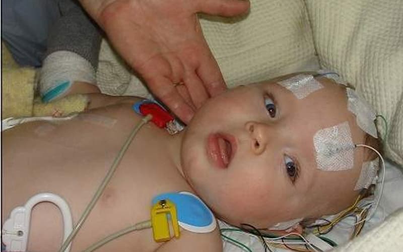 viêm màng não có để lại di chứng không