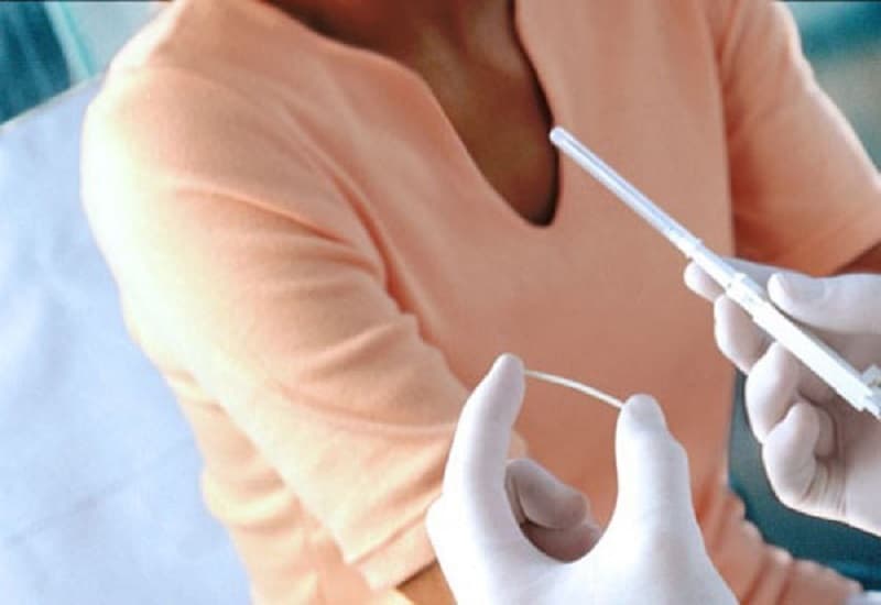 bị cường giáp có cấy que tránh thai được không