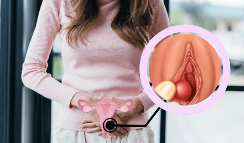 bóc nang tuyến Bartholin bao lâu thì lành