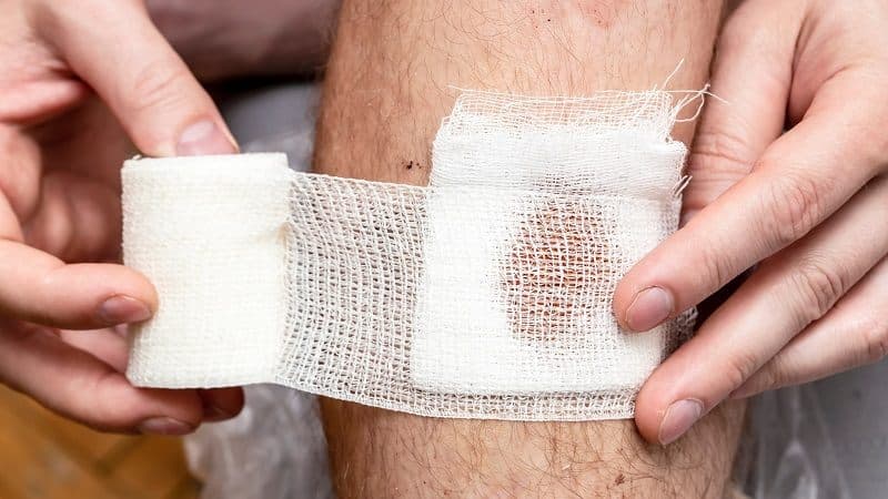 bôi thuốc kháng sinh vào vết thương hở