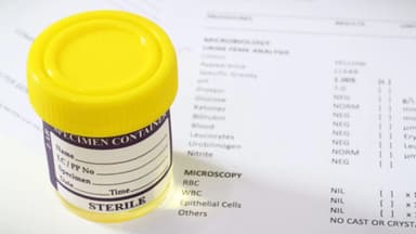 Cách đọc chỉ số xét nghiệm nước tiểu bà bầu